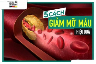 5 CÁCH GIẢM MỠ MÁU HIỆU QUẢ