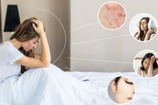 10 Dấu hiệu rối loạn nội tiết tố nữ thường gặp