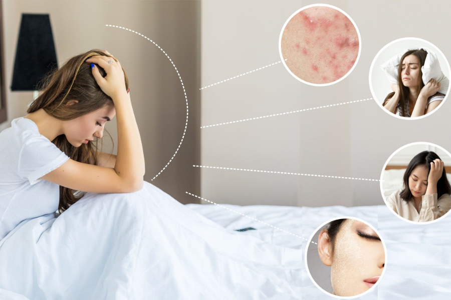 10 Dấu hiệu rối loạn nội tiết tố nữ thường gặp