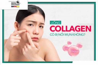 Trả lời thắc mắc: Uống collagen có nổi mụn không?