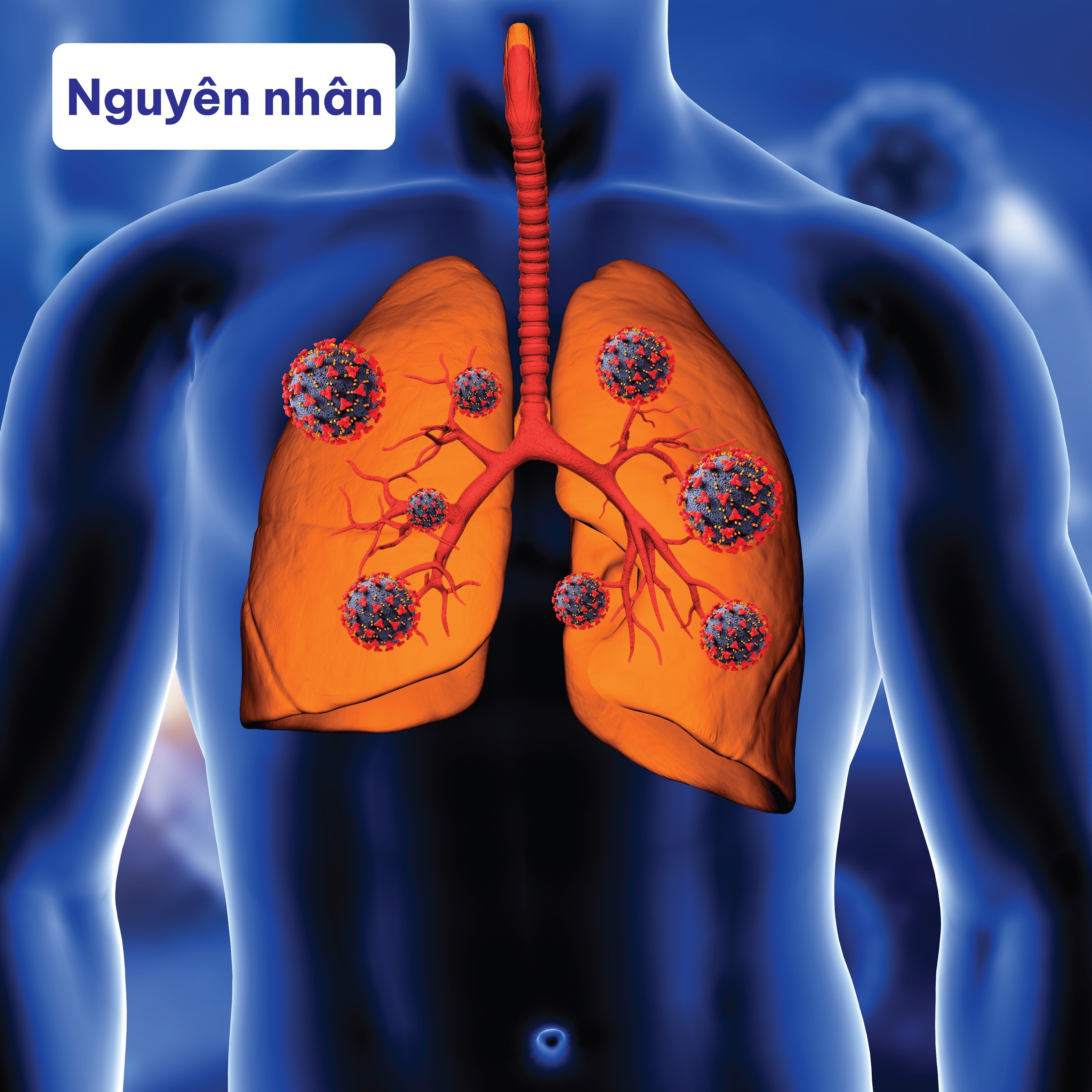 Nguyên nhân gây viêm phế quản-phổi